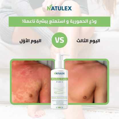 Natulex Crème Apaisante - 150ml