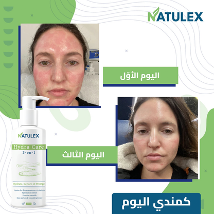 Natulex Crème Apaisante - 150ml